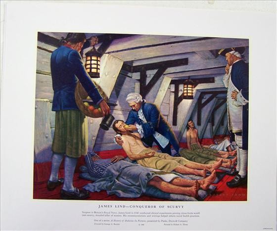 scurvy | Definition, History, & Treatment | Britannica.com